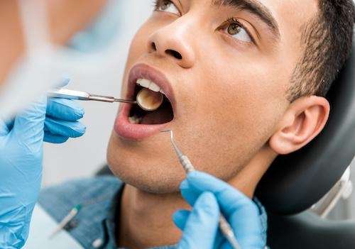 dental cleanings surf city