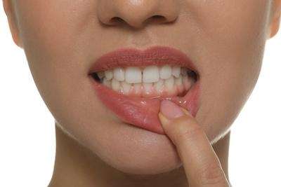 A close photo of a woman revealing her gums in Surf City, NC