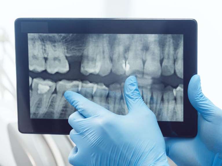 hampstead dentist | dental x-rays