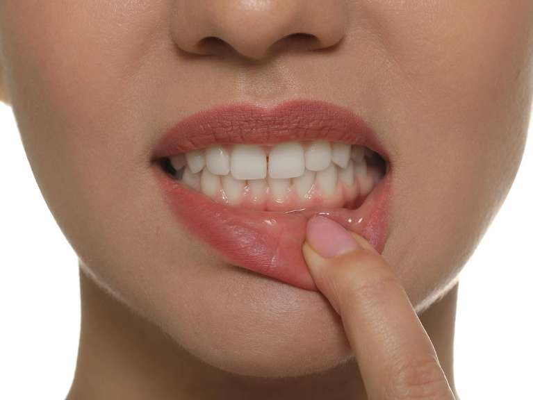 dentist surf city | woman with plaque