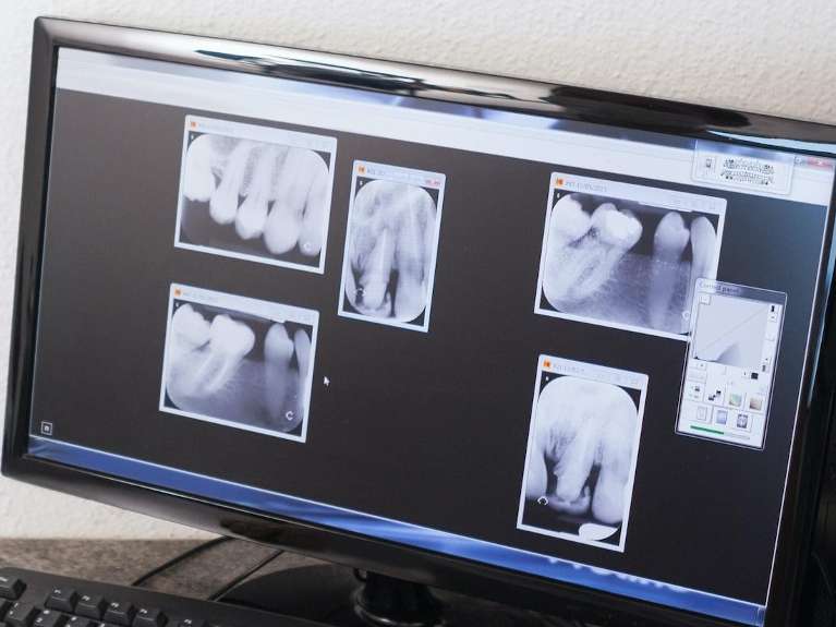 dentist surf city | Digital X-Rays | Surf City Dental