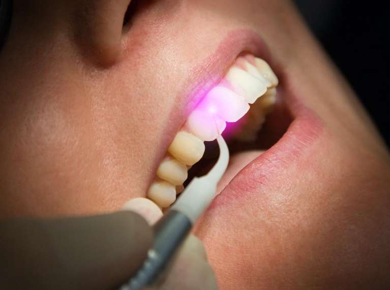 Laser dentistry at Surf City Dental | Surf City, NC