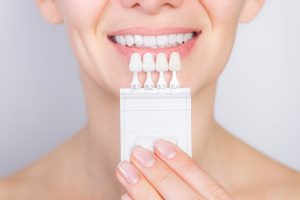 Woman smiling and holding a teeth shade guide, showcasing professional teeth whitening results for cosmetic dentistry.