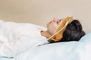 Patient undergoing sleep study with monitoring equipment on head, assessing breathing patterns and sleep disruptions for sleep apnea evaluation.